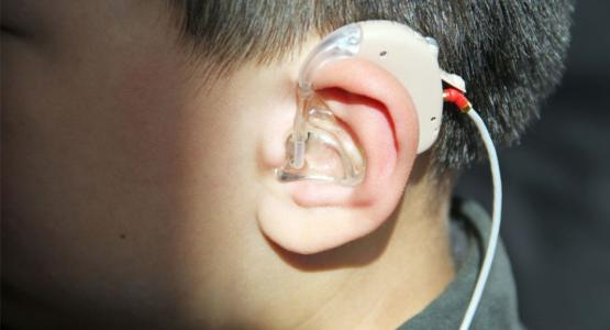 第19个全国爱耳日 聊城14名听障人士获赠助听器
