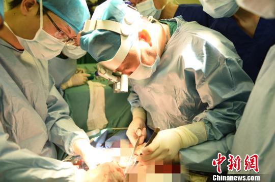 广东医疗团队成功实施首例“无缺血”肾移植