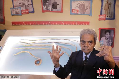 留了66年、总长超9米：印度男子终于剪掉指甲