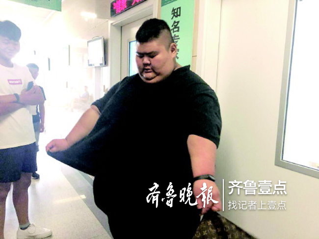 “山东第一胖”一个月减肥124斤,他希望减到300斤以内