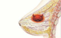 哺乳期别光顾带娃！专家：此时更要警惕乳腺癌