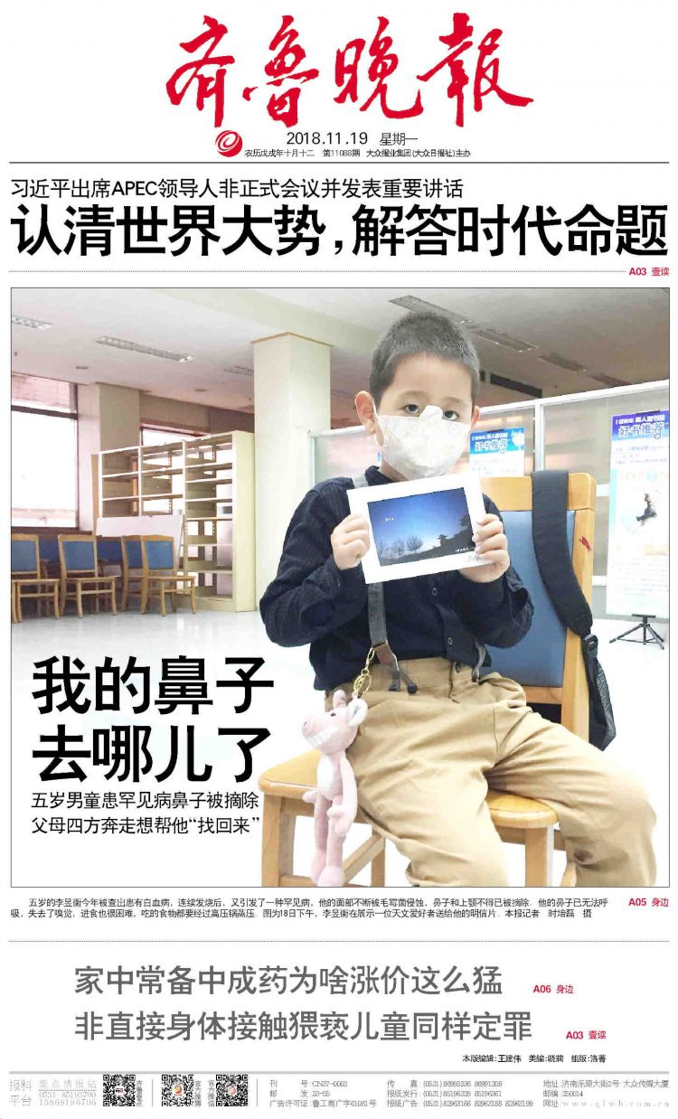 五岁男童患罕见病鼻子被摘除，谁能帮帮他