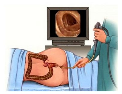 什么样的腹痛是肠肿瘤 1548639703341.png