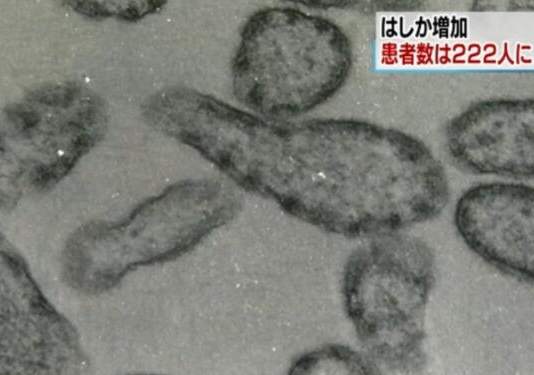 赴日旅游小心！日本麻疹疫情蔓延，高达222人确诊
