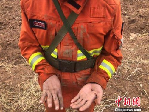 沁源山火“村庄保卫战”：消防员赤脚下河取水 手伤累累
