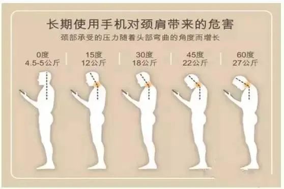 德州市中医院骨伤科专家为您讲解颈椎曲度变直那些事