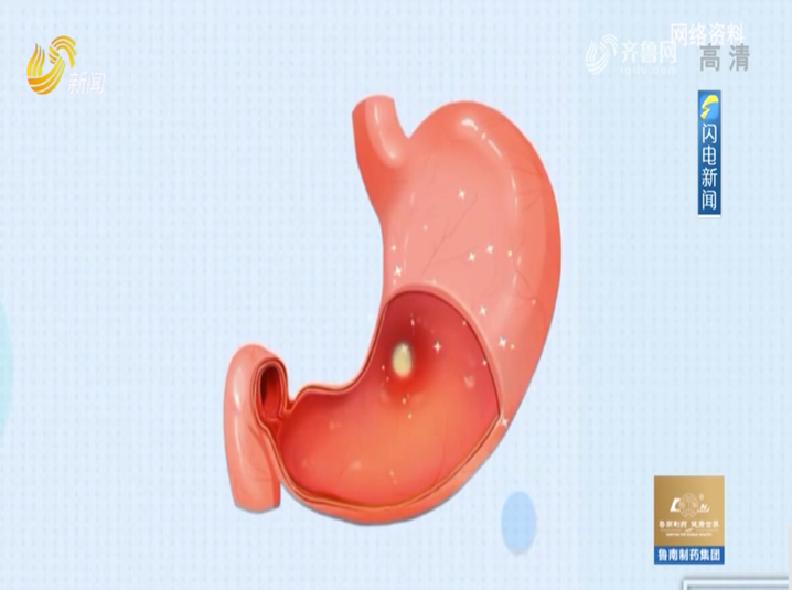 胃炎离胃癌有多远？