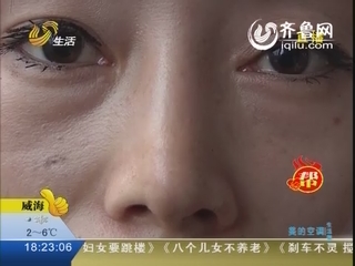 青岛:一<em>女士</em>整容整成<em>歪鼻子</em> 俩鼻孔不一样_视