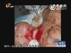 合肥花季少女被毁容案的真相和背后