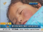 济南：首批6名西藏先心病患儿顺利完成手术