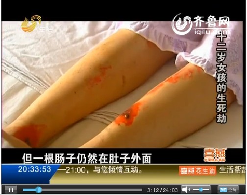 十二岁女孩的生死劫 惨遭强奸右眼几乎失明