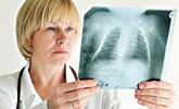 解密肺癌的症状与危害