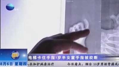 山东健康新闻20150806期：电梯卡住手指  1岁半女童手指被绞断