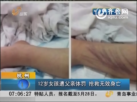 杭州：12岁女孩遭父亲体罚 抢救无效身亡
