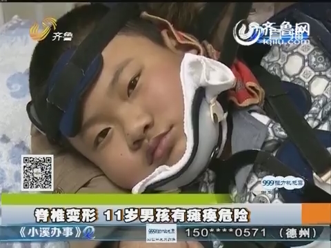 特别救助：脊椎变形 11岁男孩有瘫痪危险