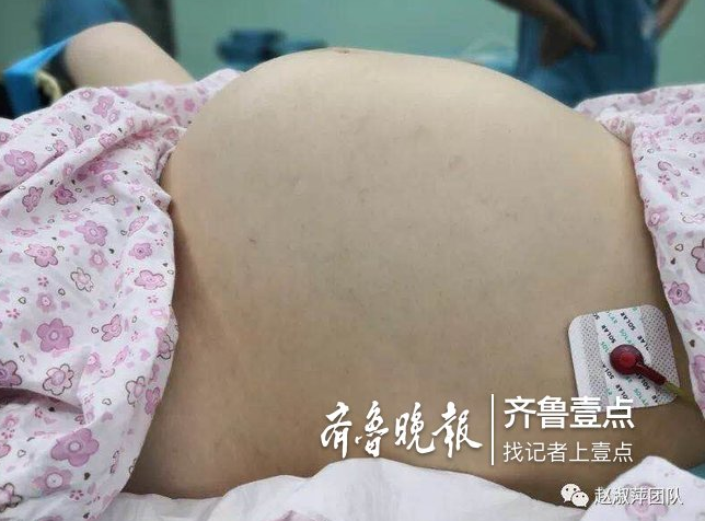20岁女孩肚子鼓胀如孕妇 肚里竟然长35厘米大肿瘤