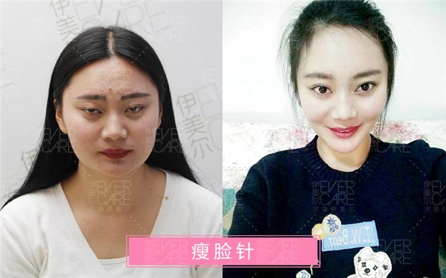 圖片2