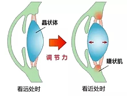 4.webp