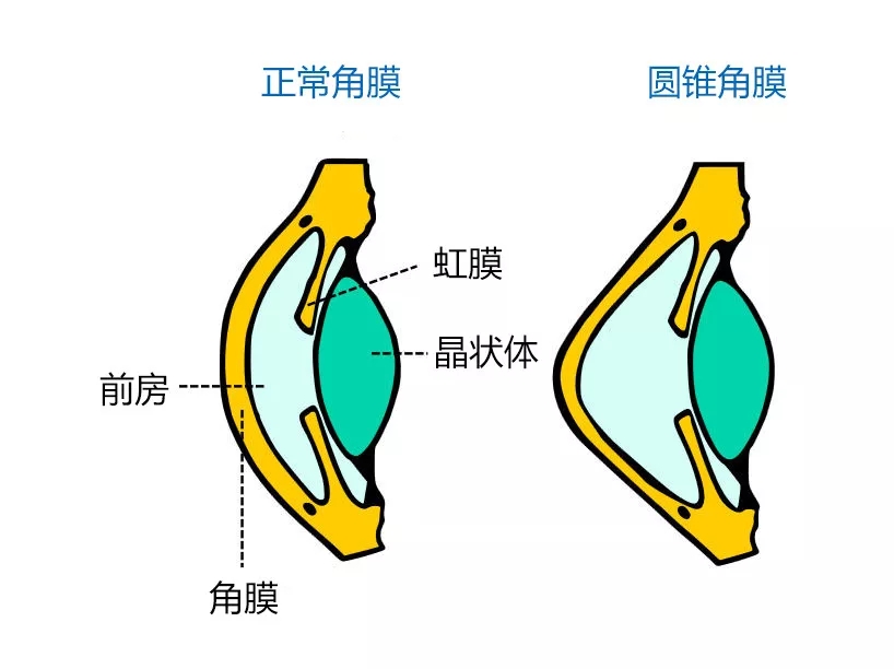 2.webp