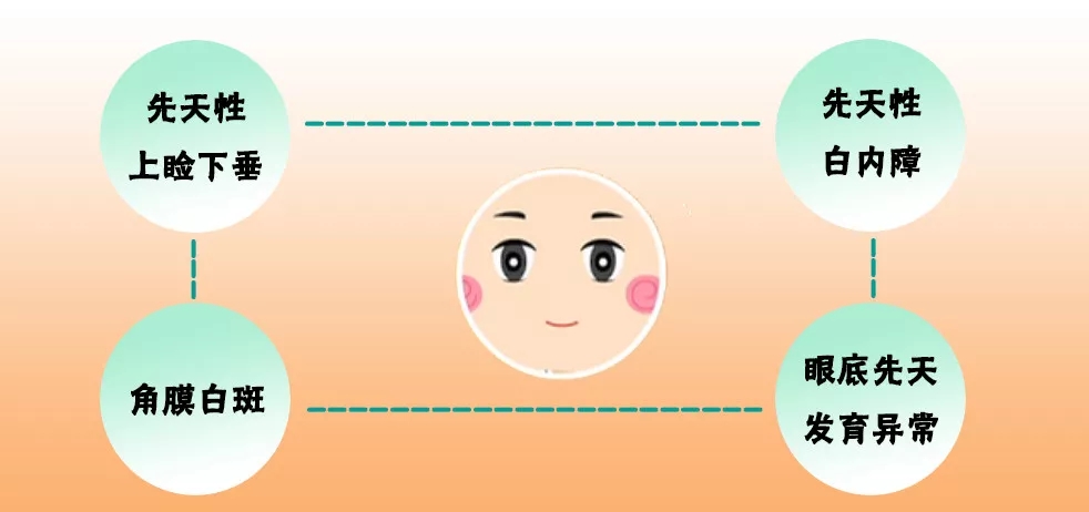 5.webp