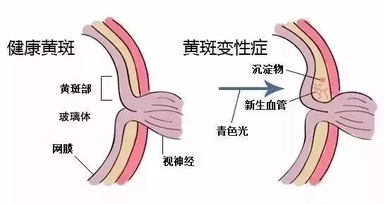 1.webp