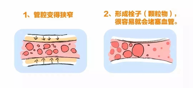 3.webp