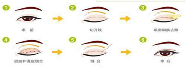 圖片6