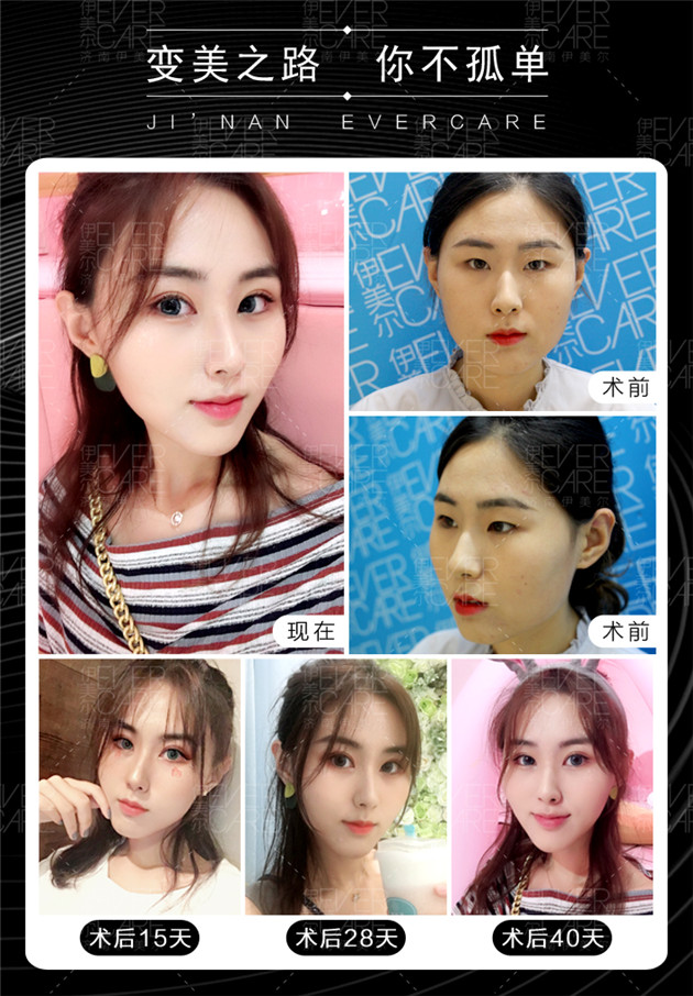 圖片2