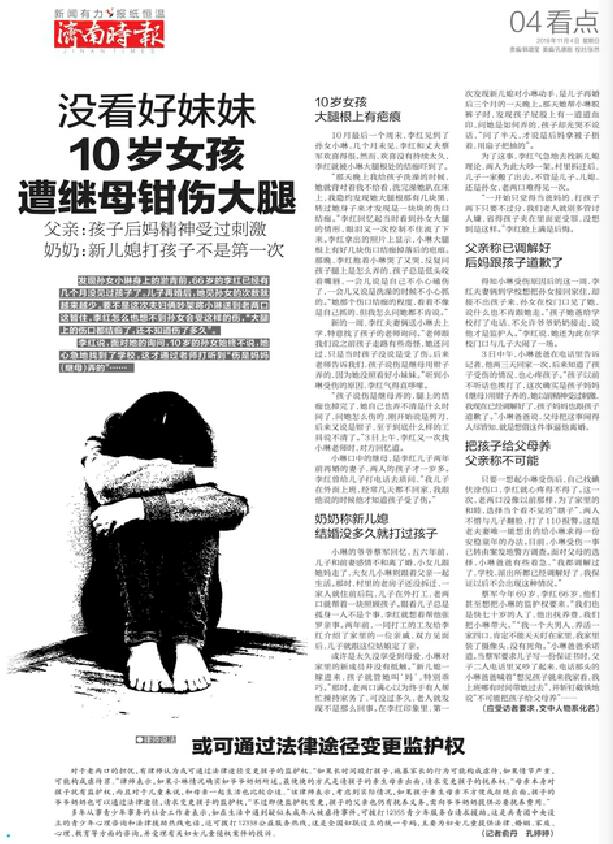 10歲女孩遭繼母鉗傷大腿，父親：繼母精神受過刺激