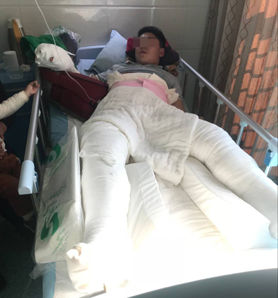 濟南奧體東路附近供暖管道爆裂！14歲中學(xué)生和一市民被燙傷