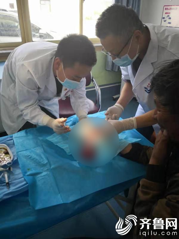 来自济南市中心医院的李磊在为患者做清创缝合手术