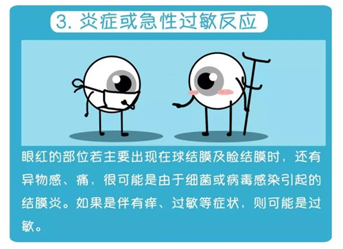 640.webp (3)
